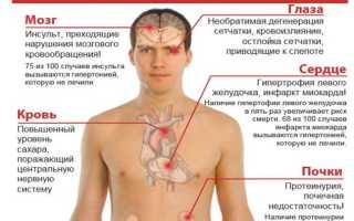 Гипертония — обратите внимание на нервную систему