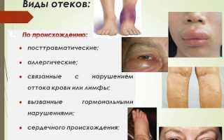 Отечность: симптомы и лечение