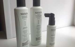 Что такое алопеция у женщин: причины и лечение облысения