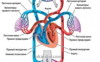 Желудочковая тахикардия