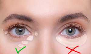 Чем и как замазать синяки под глазами: эффективные косметические средства