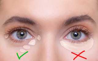 Чем и как замазать синяки под глазами: эффективные косметические средства