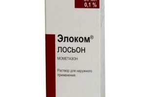 Алопеция: причины и лечение выпадения волос