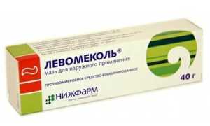 11 способов лечения грибка ногтей на ногах йодом