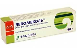 11 способов лечения грибка ногтей на ногах йодом