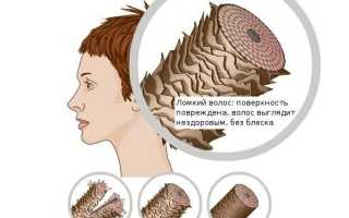 Диффузное выпадение волос: причины и способы лечения