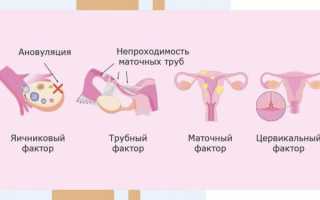 Почему не получается забеременеть – ряд основных проблем