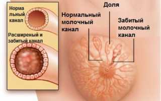 Если болит грудь при кормлении: устраняем причину