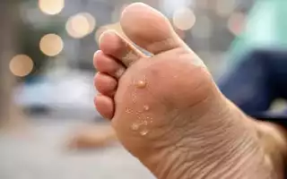 Как можно избавиться от сухой мозоли на ноге в домашних условиях