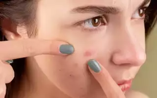 Как избавиться от следов от прыщей – заживление ранок