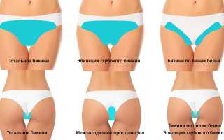 Глубокая эпиляция бикини: сексапильная деталь