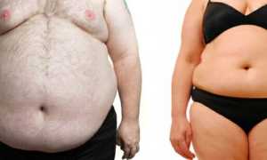 Ожирение: виды, степени и методы лечения