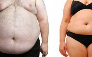 Ожирение: виды, степени и методы лечения