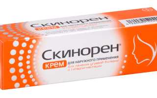 Скинорен гель – от проблем с жирной кожей