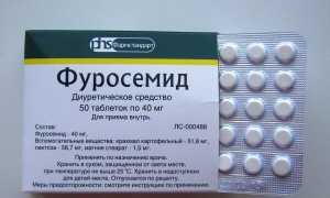 Какие мочегонные средства помогут при отеках лица в домашних условиях