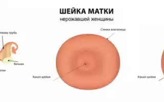Матка при беременности: какие изменения происходят?