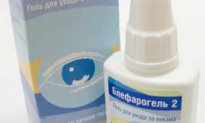 Как быстро убрать отеки под глазами в домашних условиях