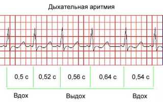 Пульс у ребенка норма