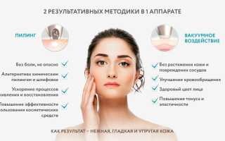 Микродермабразия — безболезненно и эффективно