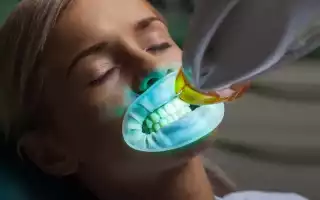 Профессиональное отбеливание зубов