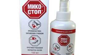 Как правильно обработать обувь от грибка стопы в домашних условиях