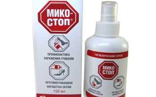 Как правильно обработать обувь от грибка стопы в домашних условиях