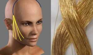 Золотые нити для лица: процедура для сохранения молодости