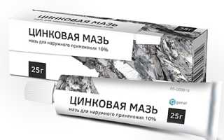 Цинковая мазь в косметологии – широко используемое средство