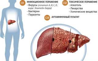 Болезни печени — как понять в чем причина?