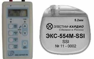 Установка кардиостимулятора как происходит