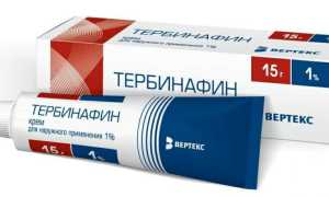 Лучшие недорогие противогрибковые препараты для ногтей