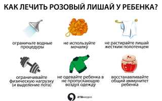Лишай у детей: необходимо выяснить вид заболевания