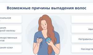 Норма выпадения волос в день у женщин и способы подсчета