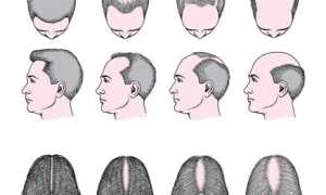 Как выбрать лучшие таблетки для роста волос