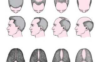 Как выбрать лучшие таблетки для роста волос