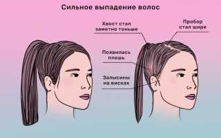 Частичное выпадение волос – повод для серьезного беспокойства