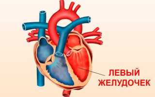 Умеренные изменения миокарда