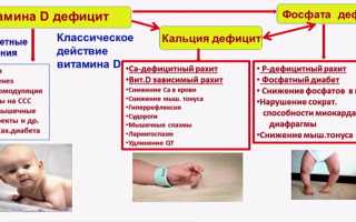 Рахит у детей – слабости организма из-за нехватки витамина D