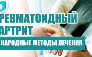 Артрит: лечение народными средствами в современных условиях