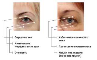 Методы омоложения: как повернуть время вспять
