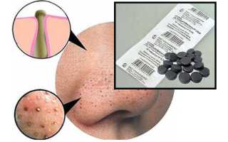 Очищающие маски для лица на основе желатина и активированного угля в домашних условиях