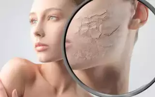 Что необходимо знать о сухой коже?