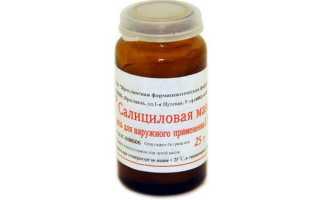 Сухая мозоль на стопе: причины и лечение в домашних условиях