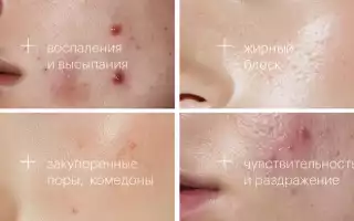 Проблемная кожа: боритесь с несправедливостью