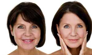 Самые эффективные маски для лица от морщин после 50 лет