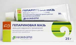 Как убрать мешки под глазами медикаментозными и народными средствами