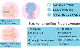 Нетрадиционные методы лечения остеохондроза – все способы хороши