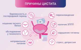 Острый цистит – лечение обязательно