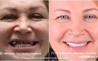 Как выглядеть моложе: комплекс мер как новый образ жизни