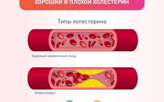 Холестерин и менопауза – опасное соседство